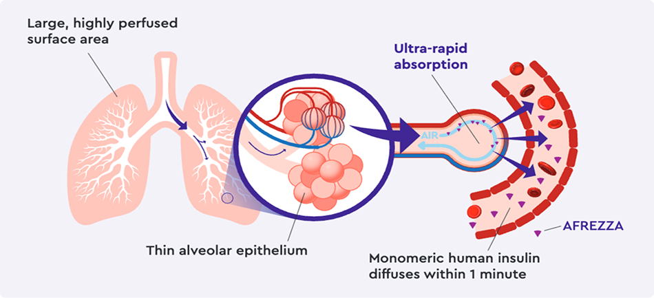 Human Insulin